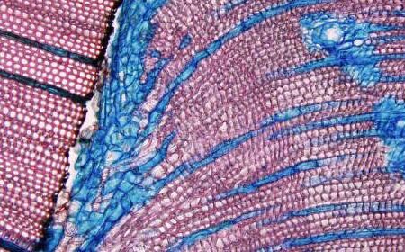 Microscopic view of plant stem cross-section showing pink xylem cells and blue-stained vascular bundles in a detailed cellular pattern.