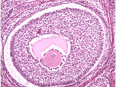 Reproductive health